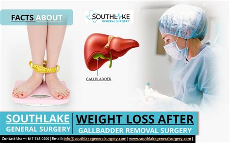 Reclaim Your Health and Vitality: How Gallbladder Surgery Can Help You Lose Weight